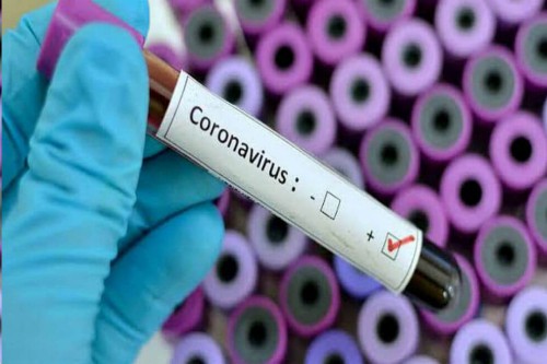  Medidas preventivas se toman en Colombia frente al nuevo coronavirus